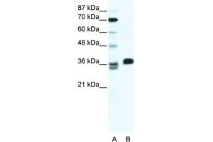 Western Blotting (WB) image for anti-ESX Homeobox 1 (ESX1) antibody (ABIN2461319) (ESX Homeobox 1 antibody)