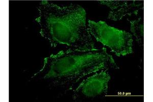 Immunofluorescence of monoclonal antibody to RHOJ on HeLa cell. (RHOJ antibody  (AA 1-214))
