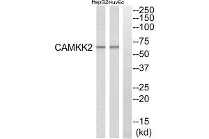 Western blot analysis of extracts from HuvEc cells and HepG2 cells, using CAMKK2 antibody. (CAMKK2 antibody  (Internal Region))