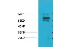 Western Blot (WB) analysis of 293T with KV1. (KCNA5 antibody)