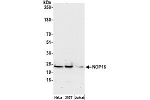 anti-Nucleolar Protein 16 (NOP16) (AA 75-125) antibody