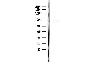 anti-Deltex Homolog 2 (DTX2) (C-Term) antibody