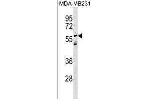 LGI3 Antibody (Center) (ABIN1881494 and ABIN2838431) western blot analysis in MDA-M cell line lysates (35 μg/lane). (LGI3 antibody  (AA 310-338))