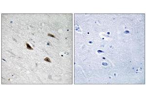 Immunohistochemistry analysis of paraffin-embedded human brain tissue using Catenin- beta (Phospho-Tyr489) antibody. (beta Catenin antibody  (pTyr489))