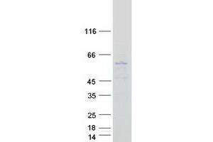 Western Blotting (WB) image for Transmembrane Protein 79 (TMEM79) (Transcript Variant 1) protein (Myc-DYKDDDDK Tag) (ABIN2733907)