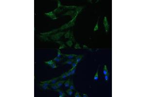 Immunofluorescence analysis of C6 cells using  Polyclonal Antibody (ABIN7265493) at dilution of 1:100 (40x lens). (ARL3 antibody  (AA 1-182))