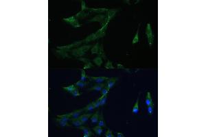 Immunofluorescence analysis of C6 cells using  Polyclonal Antibody (ABIN7265493) at dilution of 1:100 (40x lens). (ARL3 antibody  (AA 1-182))