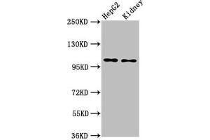 Western Blot Positive WB detected in: HepG2 whole cell lysate, Rat kidney tissue All lanes: PCSK5 antibody at 6 μg/mL Secondary Goat polyclonal to rabbit IgG at 1/50000 dilution Predicted band size: 207, 102 kDa Observed band size: 102 kDa (PCSK5 antibody  (AA 201-500))