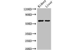 Western Blot Positive WB detected in: Mouse kidney tissue, Mouse liver tissue All lanes: ALDH6A1 antibody at 2.