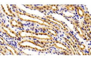 Detection of FEz2 in Rat Kidney Tissue using Polyclonal Antibody to Fasciculation And Elongation Protein Zeta 2 (FEz2) (FEZ2 antibody  (AA 1-375))