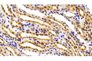 Detection of FEz2 in Rat Kidney Tissue using Polyclonal Antibody to Fasciculation And Elongation Protein Zeta 2 (FEz2) (FEZ2 antibody  (AA 1-375))