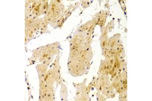 Immunohistochemistry of paraffin-embedded human esophagus using MVP Antibody (ABIN5971029) at dilution of 1/100 (40x lens).