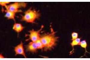 Immunocytochemistry of anti-ANG2 Antibody in PC12 cells Tissue: Human prostate cancer cell line (PC12) Fixation: 5 min in 100% methanol Ag Retrieval/permeabilization: 1hr 1%BSA / 10% normal goat serum / 0. (Angiopoietin 2 antibody  (N-Term))