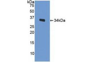 Detection of Recombinant LRP1, Mouse using Polyclonal Antibody to Low Density Lipoprotein Receptor Related Protein 1 (LRP1) (LRP1 antibody  (AA 692-962))
