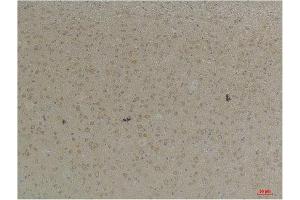 Immunohistochemistry (IHC) analysis of paraffin-embedded Mouse Brain Tissue using KCNK4 (TRAAK) Rabbit Polyclonal Antibody diluted at 1:200.