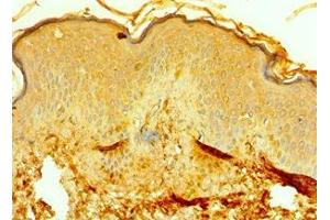 Immunohistochemistry of paraffin-embedded human skin tissue using ABIN7167638 at dilution of 1:100 (RMDN3 antibody  (AA 171-470))