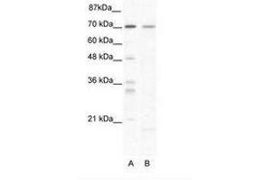 Image no. 1 for anti-SRY (Sex Determining Region Y)-Box 13 (SOX13) (C-Term) antibody (ABIN202829) (SOX13 antibody  (C-Term))