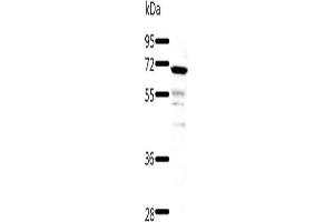 Gel: 8+10+12 % SDS-PAGE, Lysate: 60 μg, Lane: Human fetal kidney tissue, Primary antibody: ABIN7192878(TRAF3 Antibody) at dilution 1/500, Secondary antibody: Goat anti rabbit IgG at 1/8000 dilution, Exposure time: 40 seconds (TRAF3 antibody)