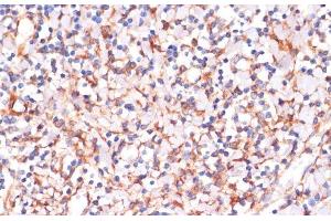 Immunohistochemistry of paraffin-embedded Human tonsil using IKK alpha Polyclonal Antibody at dilution of 1:100 (40x lens). (IKK alpha antibody)