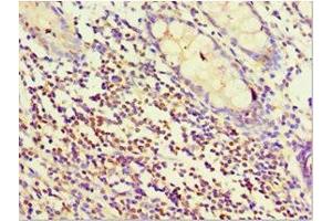 Immunohistochemistry of paraffin-embedded human colon tissue using ABIN7170823 at dilution of 1:100