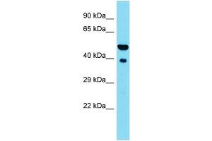 Host: Rabbit  Target Name: St13  Sample Tissue: Mouse Heart lysates  Antibody Dilution: 1. (HSC70 Interacting Protein HIP antibody  (N-Term))