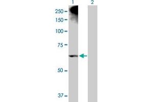 Western Blot analysis of ALOX12 expression in transfected 293T cell line by ALOX12 MaxPab polyclonal antibody. (ALOX12 antibody  (AA 1-663))