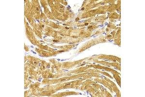 Immunohistochemistry of paraffin-embedded Mouse heart using CSRP3 antibody at dilution of 1:100 (x400 lens). (CSRP3 antibody)