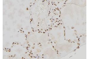ABIN6277592 at 1/100 staining Human lung tissue by IHC-P. (PER3 antibody  (Internal Region))