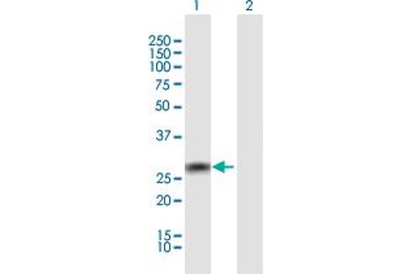TRIM72 抗体  (AA 1-269)