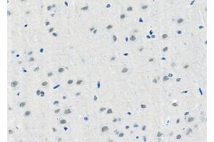 ABIN6257957 and ABIN6275973 at 1/100 staining Rat brain tissue by IHC-P. (BAI1 antibody  (Internal Region))