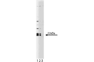 Western blot analysis of Caveolin 1 on a human endothelial lysate. (Caveolin-1 antibody  (AA 1-97))