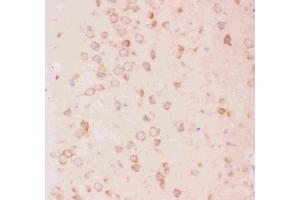 Anti-Tuberin Picoband antibody,IHC(P): Rat Brain Tissue