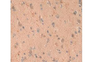 Used in DAB staining on fromalin fixed paraffin- embedded brain tissue (ARTN antibody)