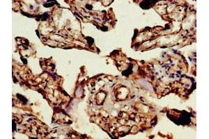 Immunohistochemistry of paraffin-embedded human placenta tissue using ABIN7144564 at dilution of 1:100 (ARAP1 antibody  (AA 69-344))
