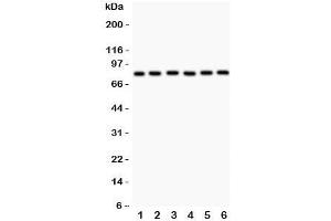 Western blot testing of MFN1 antibody and Lane 1:  rat heart;  2: (r) kidney;  3: mouset heart;  4: human HeLa;  5: (h) COLO320;  6: (h) A549. (MFN1 antibody  (N-Term))