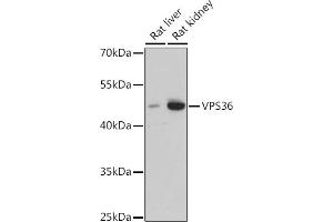 Western blot analysis of extracts of various cell lines, using VPS36 antibody (ABIN7271277) at 1:3000 dilution. (VPS36 antibody  (AA 70-220))