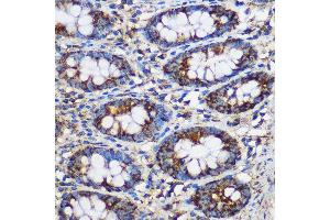 Immunohistochemistry of paraffin-embedded Human colon using TEX101 Rabbit pAb (ABIN7270773) at dilution of 1:100 (40x lens). (TEX101 antibody)