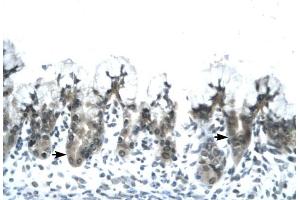 ACDC antibody was used for immunohistochemistry at a concentration of 4-8 ug/ml to stain Epithelial cells of fundic gland (arrows) in Human Stomach. (ADIPOQ antibody  (N-Term))