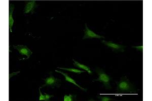 Immunofluorescence of monoclonal antibody to WBP2 on HeLa cell. (WBP2 antibody  (AA 1-261))