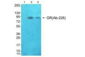 Western blot analysis of extracts from JK cells (Lane 2) and K562 cells (Lane 3), using GR(Ab-226) antiobdy. (Glucocorticoid Receptor antibody  (Ser226, Ser234, Ser246))