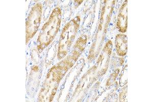 Immunohistochemistry of paraffin-embedded mouse kidney using IKBKAP Rabbit pAb (ABIN6130369, ABIN6142278, ABIN6142279 and ABIN6214265) at dilution of 1:100 (40x lens). (IKAP/p150 antibody  (AA 1093-1332))