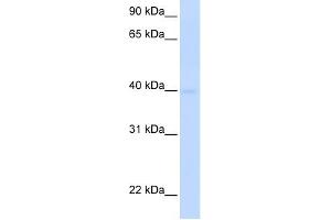 SLC25A36 antibody used at 1 ug/ml to detect target protein. (SLC25A36 antibody  (N-Term))