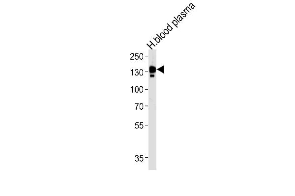 Ceruloplasmin antibody  (N-Term)