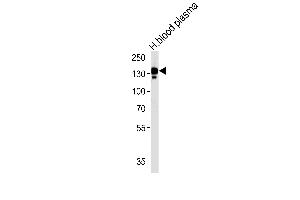CP Antibody (N-term) (ABIN391512 and ABIN2841473) western blot analysis in human blood plasma tissue lysates (35 μg/lane). (Ceruloplasmin antibody  (N-Term))