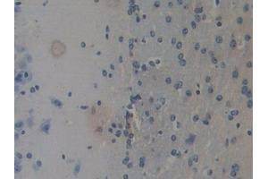 Detection of REG3b in Mouse Cerebrum Tissue using Polyclonal Antibody to Regenerating Islet Derived Protein 3 Beta (REG3b) (REG3B antibody  (AA 27-175))