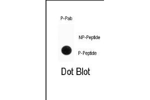 Dot blot analysis of anti-Phospho-ENT1(Slc29a1)-p Antibody (ABIN389998 and ABIN2839775) on nitrocellulose membrane. (SLC29A1 antibody  (pSer254))