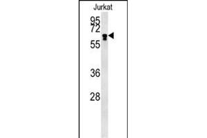 BTBD9 Antibody (Center) (ABIN651859 and ABIN2840426) western blot analysis in Jurkat cell line lysates (15 μg/lane). (BTBD9 antibody  (AA 237-262))