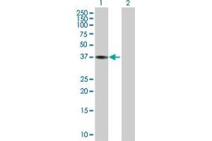 Western Blot analysis of CTSK expression in transfected 293T cell line by CTSK MaxPab polyclonal antibody.