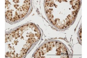 Immunoperoxidase of purified MaxPab antibody to GAGE1 on formalin-fixed paraffin-embedded human testis. (G Antigen 1 antibody  (AA 1-139))