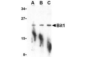 Western blot analysis of Bit1 in A-20 cell lysate with AP30152PU-N Bit1 antibody at (A) 1, (B) 2, and (C) 4 μg/ml.